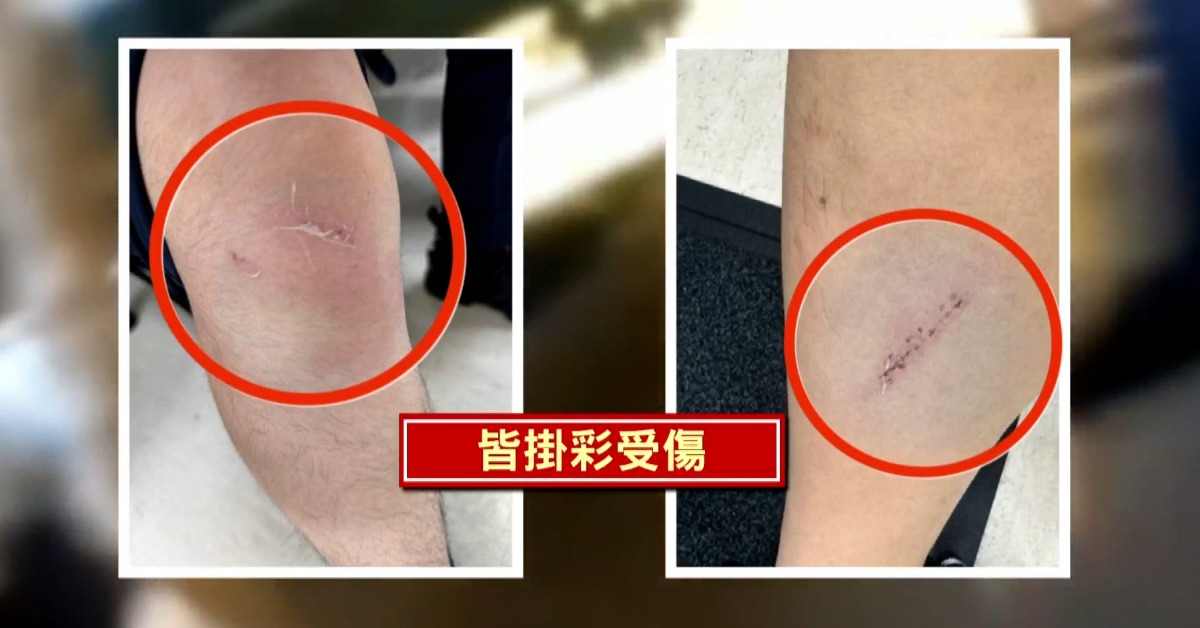 獨家／疑消費糾紛 男大鬧101蘋果門市還弄傷3警's story cover image