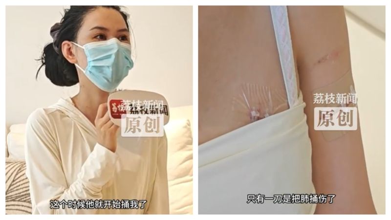 商場停車場遭挾持搶劫　她被捅20多刀「靠隆胸假體躲致命一擊」's story cover image