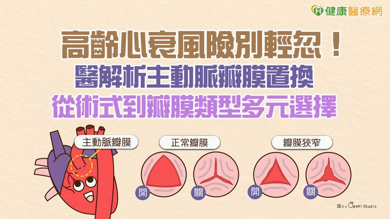 高齡心衰風險別輕忽！醫解析主動脈瓣膜置換　從術式到瓣膜類型多元選擇's story cover image