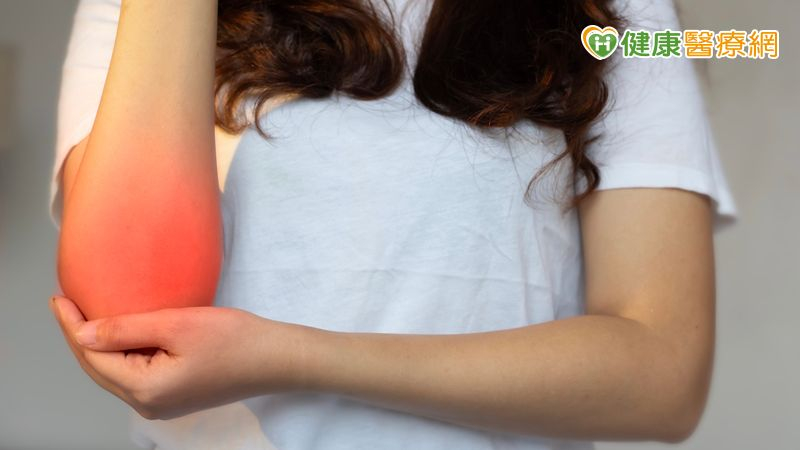 35歲會計師手肘痛3年！竟不是單純網球肘　微創手術助改善's story cover image