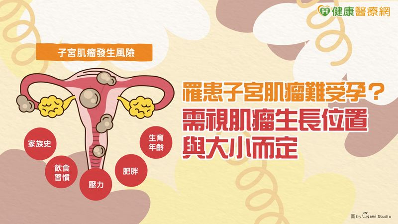 罹患子宮肌瘤難受孕？需視肌瘤生長位置與大小而定's story cover image
