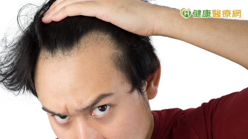 35 歲男髮際線後退「M型禿」！中醫「1治療」改善掉髮、新髮冒出's story cover image