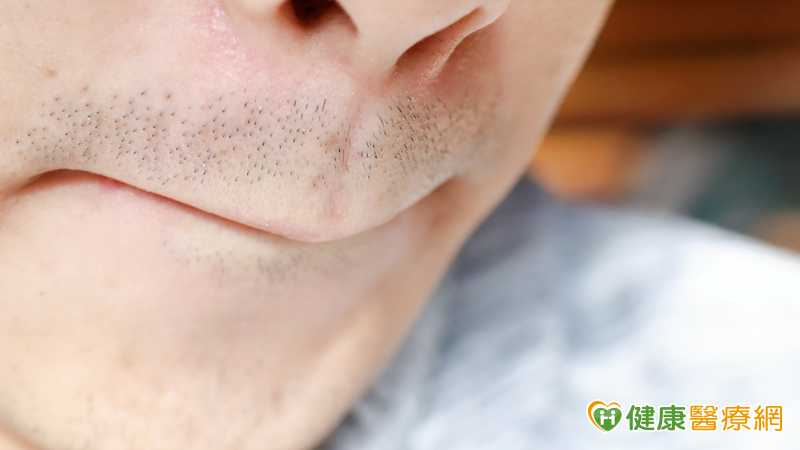 男鬍子變濃竟和「天天DIY」有關？　醫搖頭：2關鍵決定's story cover image