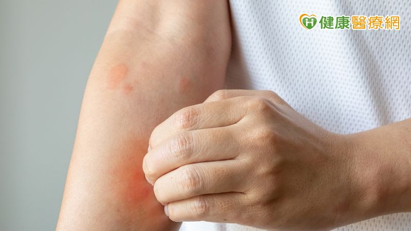 乾癢脫屑反覆發作　可能不只是氣候乾燥！中醫談常見類型與日常保養's story cover image