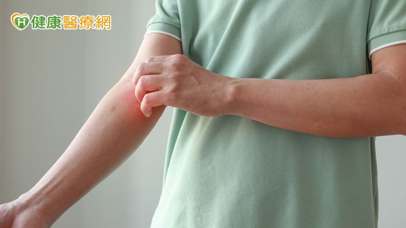 過敏族注意！醫揭「異病同治」新觀念　治療方式大改變's story cover image