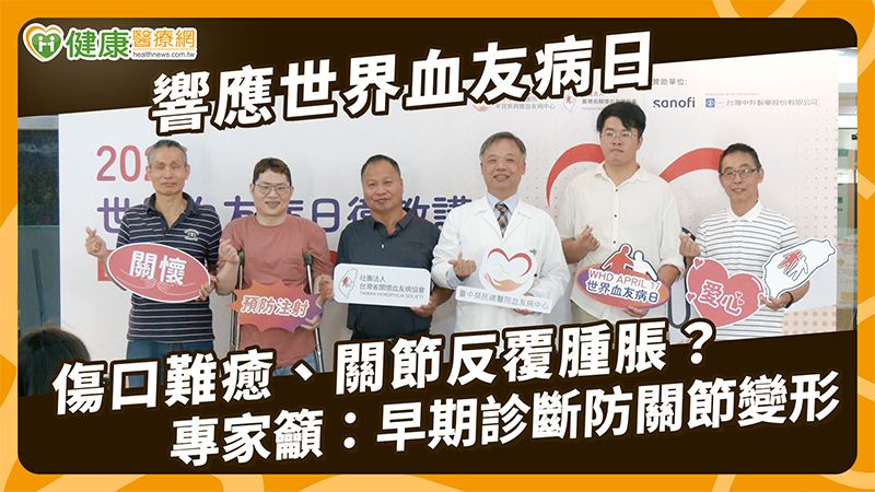 血友病不只「容易瘀青」！醫：反覆出血恐影響關節　拖延恐增加風險's story cover image
