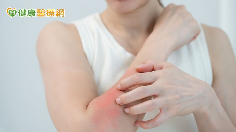 夏天皮膚癢原因大不同　為何汗水或衣物也可能是刺激來源？皮膚醫解析's story cover image
