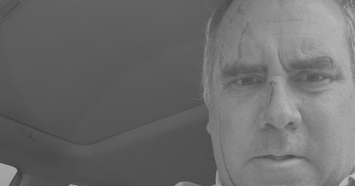 祕魯總統參選人「滿臉是血」 遭開3槍彈孔照曝光's OG Image